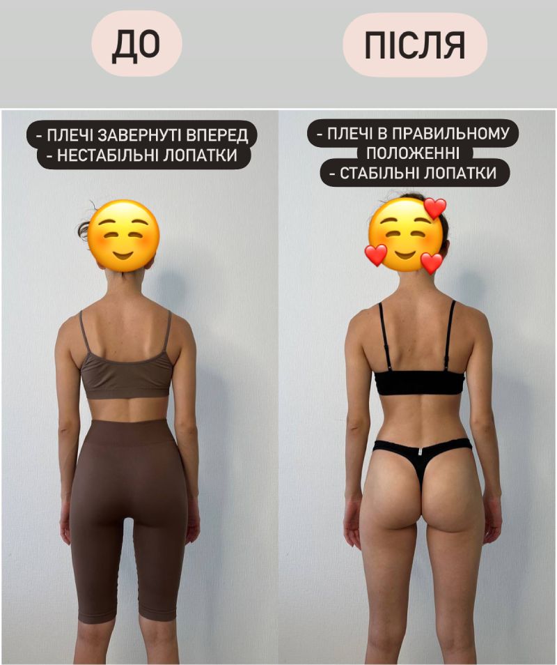 до-після-1